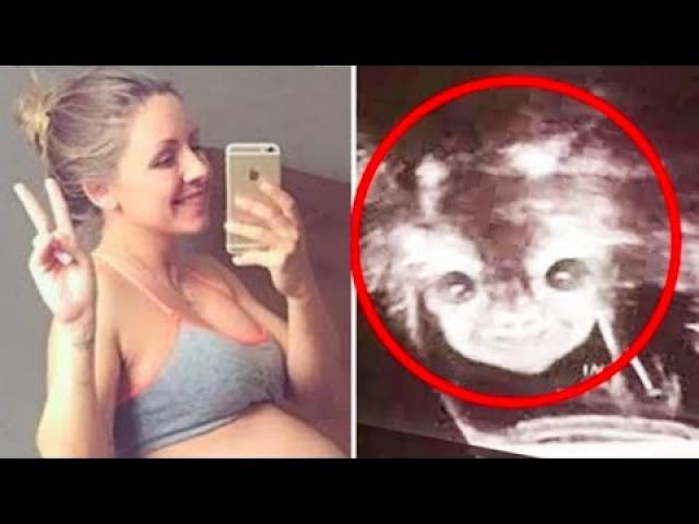 DAD SEES BABY’S FACE IN ULTRASOUND AND FILES FOR DIVORCE