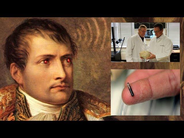 Scientist Claims to Have Found Alien Chip in Napoleon Bonaparte’s Skull