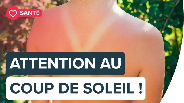 Coup de soleil : comment l’éviter et le soigner | Futura