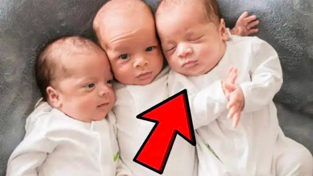 Mother Gives Birth to Perfectly Normal Triplets – But Then Her Third Child Opens Her Eyes!