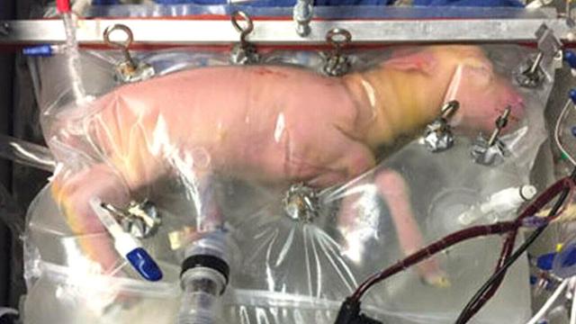 An Artificial Womb Successfully Grew Baby Sheep — And Humans Could Be Next