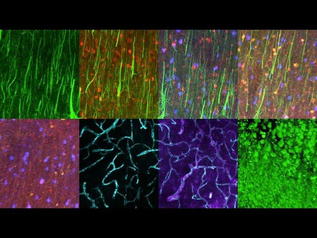 Imaging brain proteins