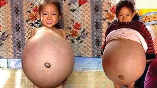 The World’s Youngest Mother Who Gave Birth in This Age !