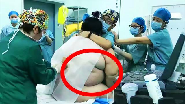 Doctor Is Shocked By What He Saw When A Mother Gave Birth To Triplets