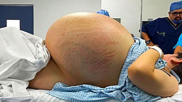 Woman Gives Birth, What Happened Next Surprised Even The Doctors