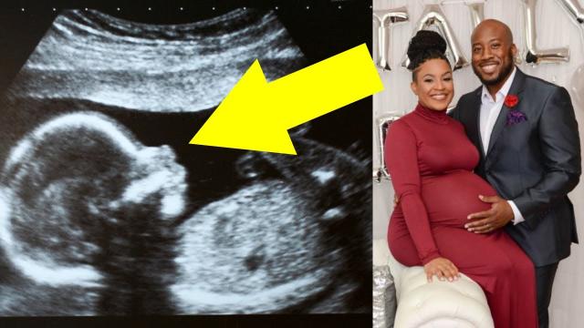 This Expectant Couple Couldn’t Believe What Their Ultrasound Revealed