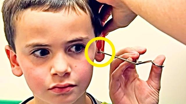 Kid Says He’s Got A Pencil Stuck In His Ear, But Doctor Pulls Out Something Much Worse