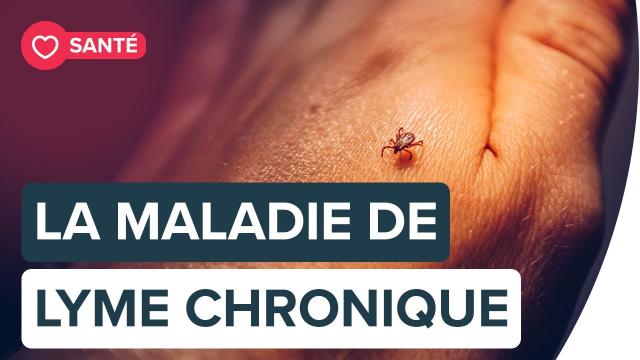 La maladie de Lyme chronique | Futura